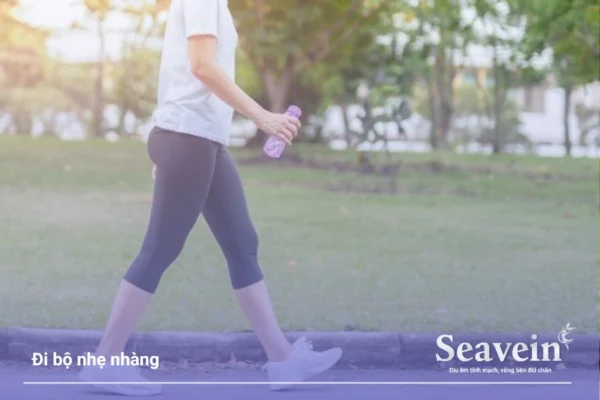 Hướng Dẫn Điều Trị Giãn Tĩnh Mạch Chân Tại Nhà Hiệu Quả