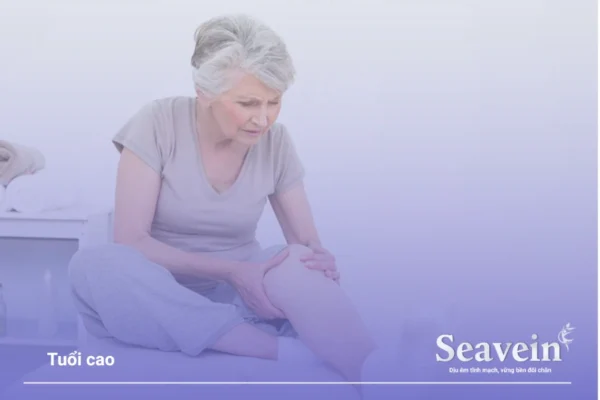 Nguyên nhân gây suy giãn tĩnh mạch